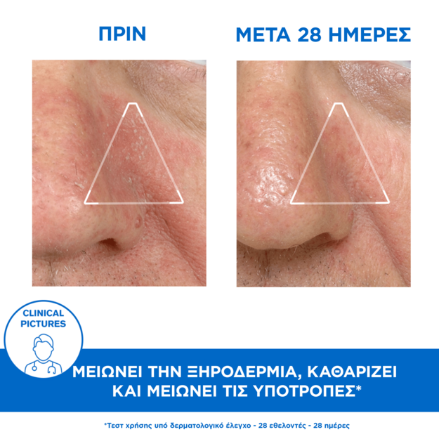 URIAGE - D.S. Emulsion - 40ml